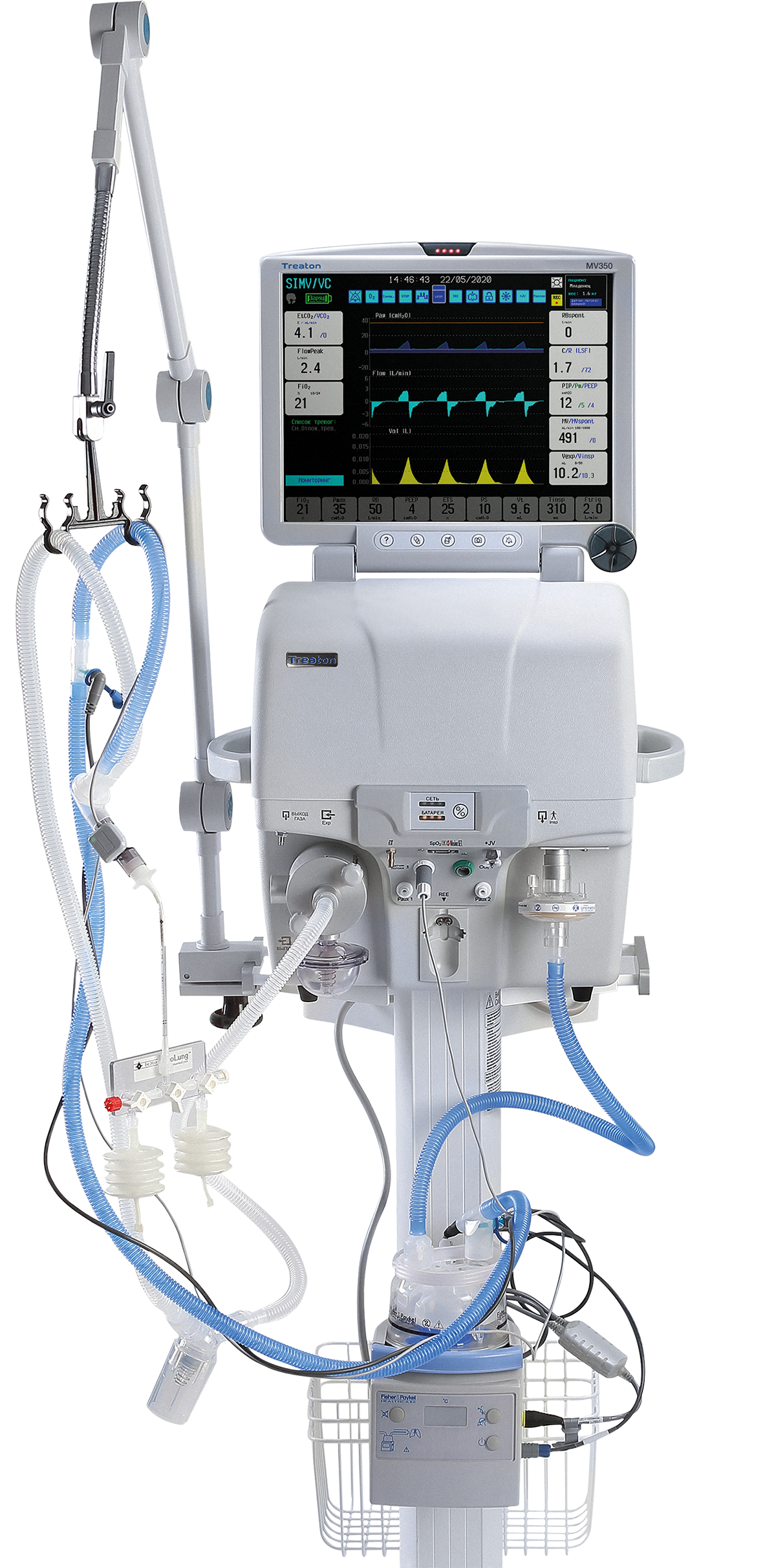 Minimum tidal volume from 1 ml Minimum tidal volume from 1 ml